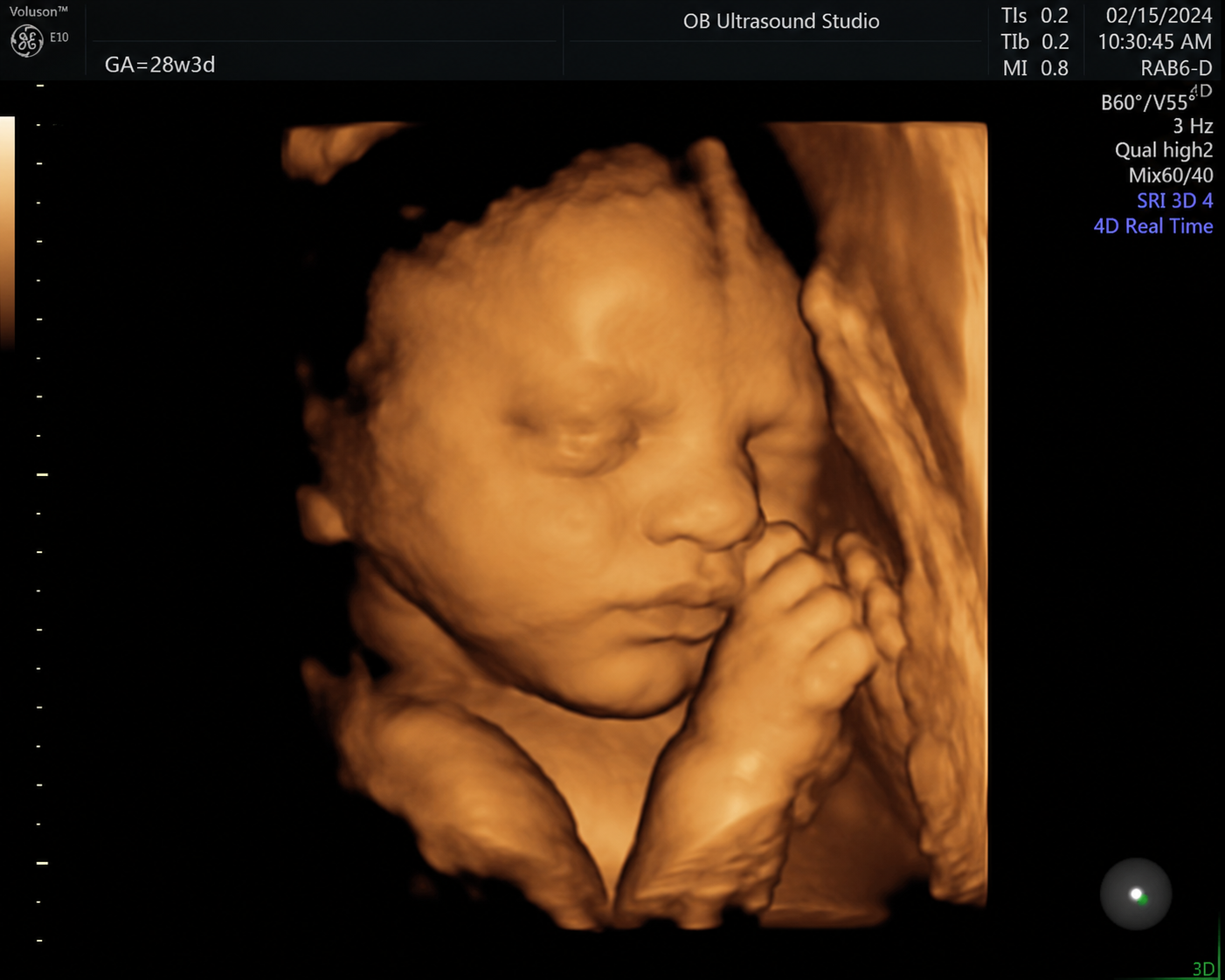 4D ultrasound close-up