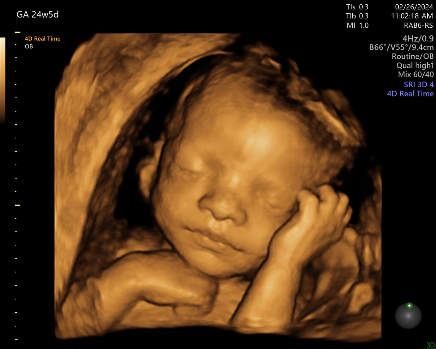 4D ultrasound detail