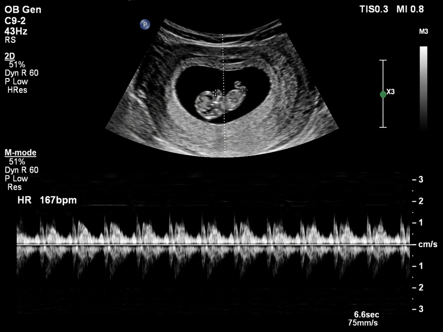 Heartbeat Scan
