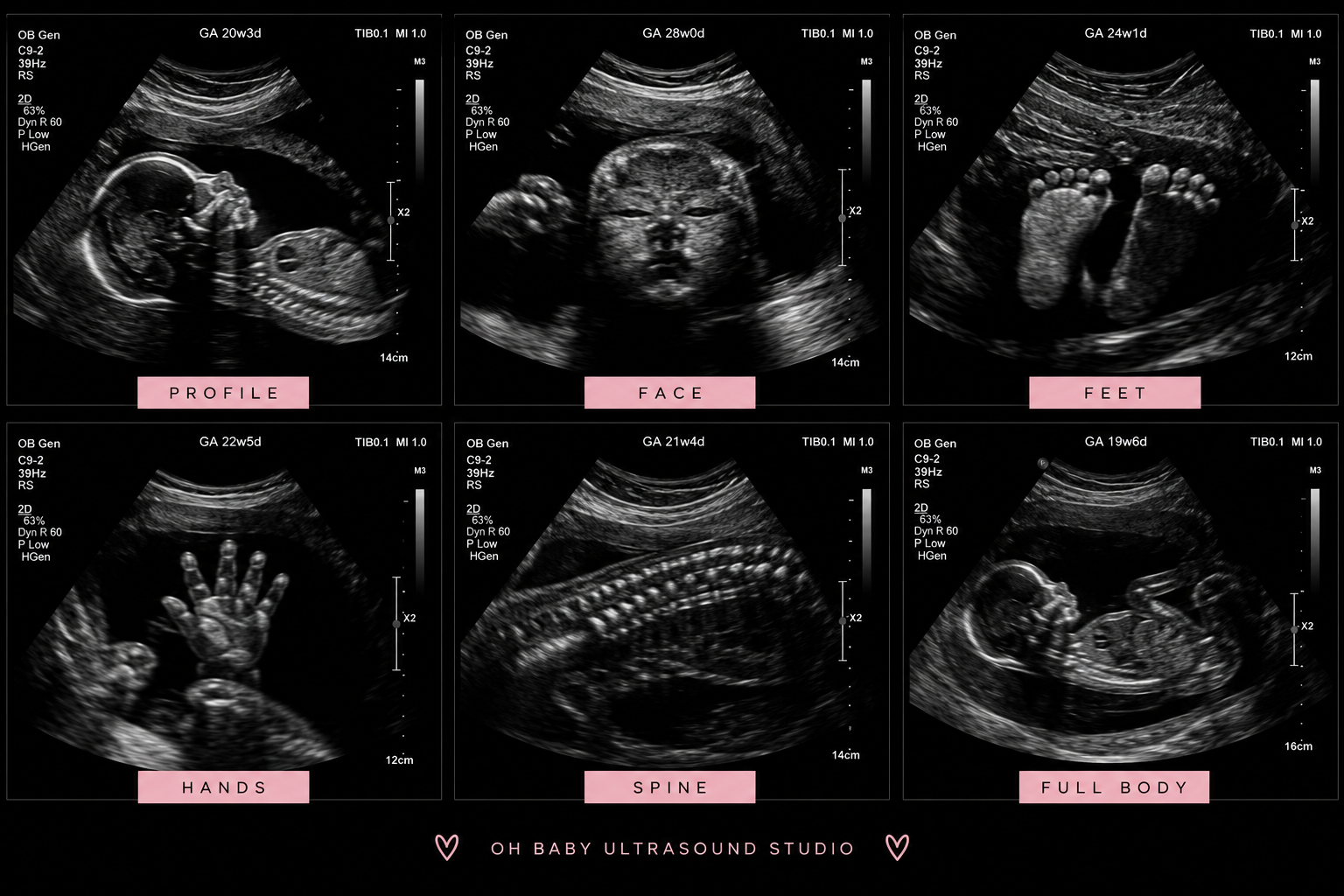 2D Ultrasound Collage